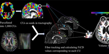 MRI-tile.jpg MRI analysis